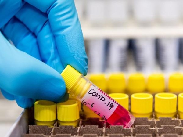 New cheaper Covid-19 rapid test kit receives scientific seal of approval
